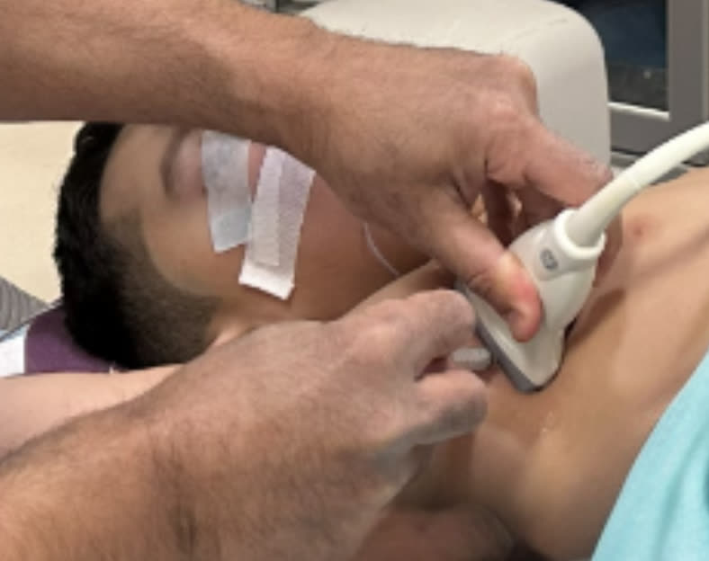 Lateral approach - needle puncture in the axilla under ultrasound guidance